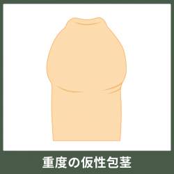 38891 B